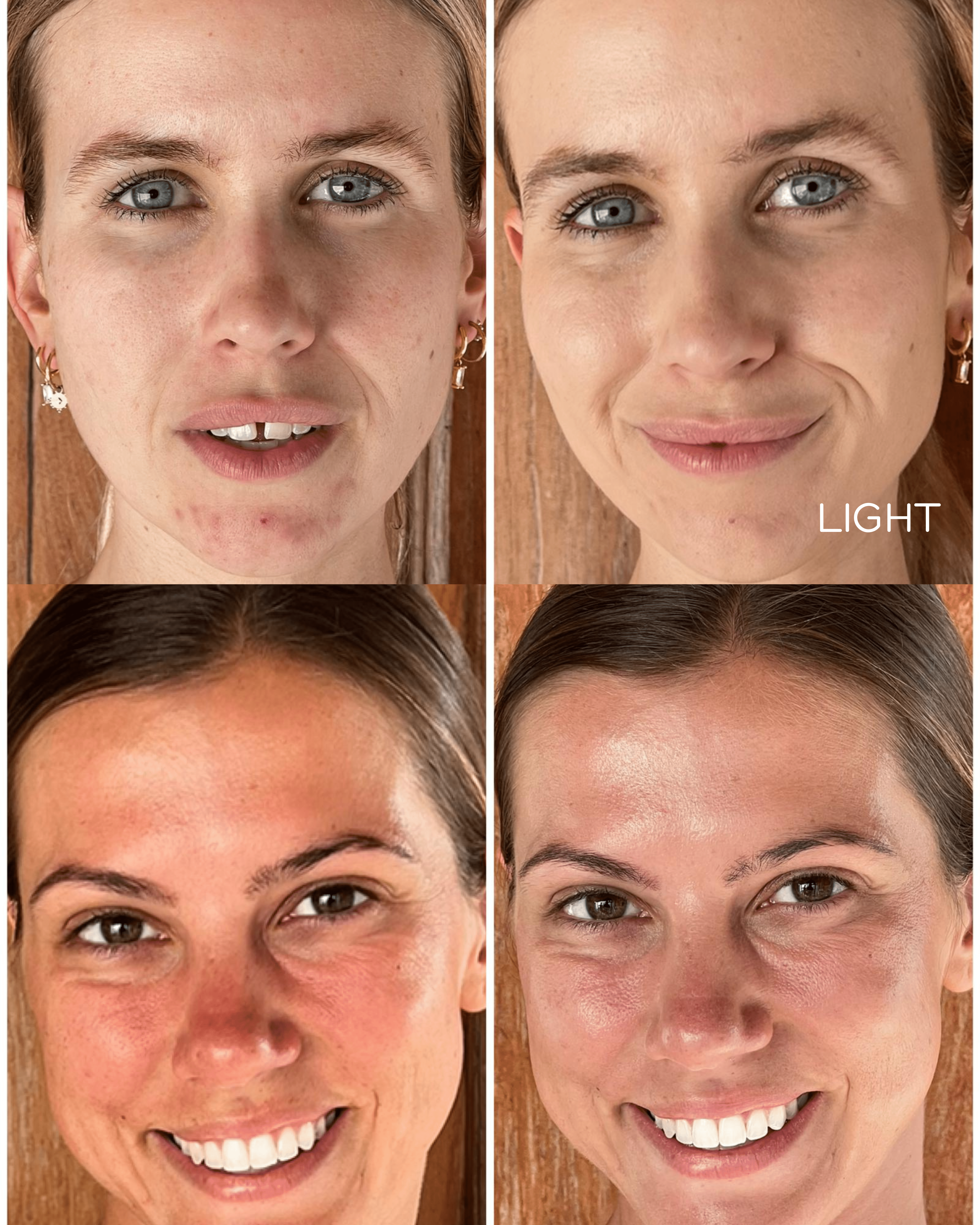 BB Cream - Get Good Face